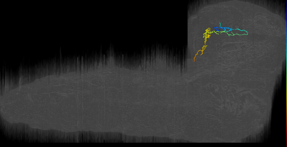 SP2-1;right (L1EM:8177199)
