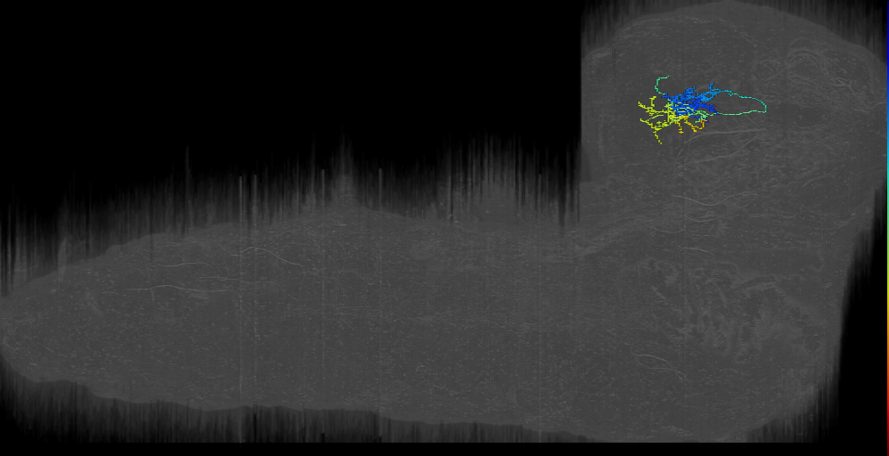 PDM1 left (L1EM:8203947)
