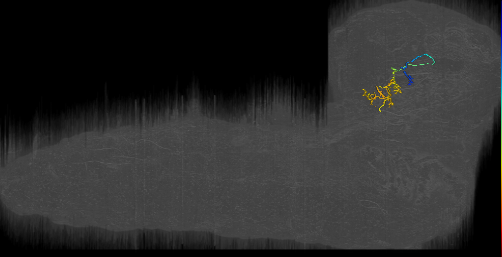 UNK bilateral gnarled dendrite left (L1EM:8529400)