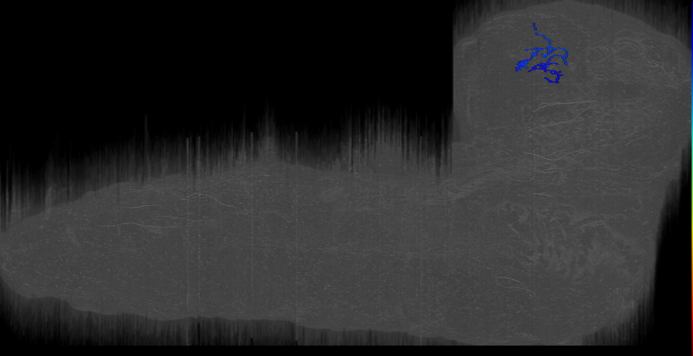 PDL1_right (L1EM:8705088)