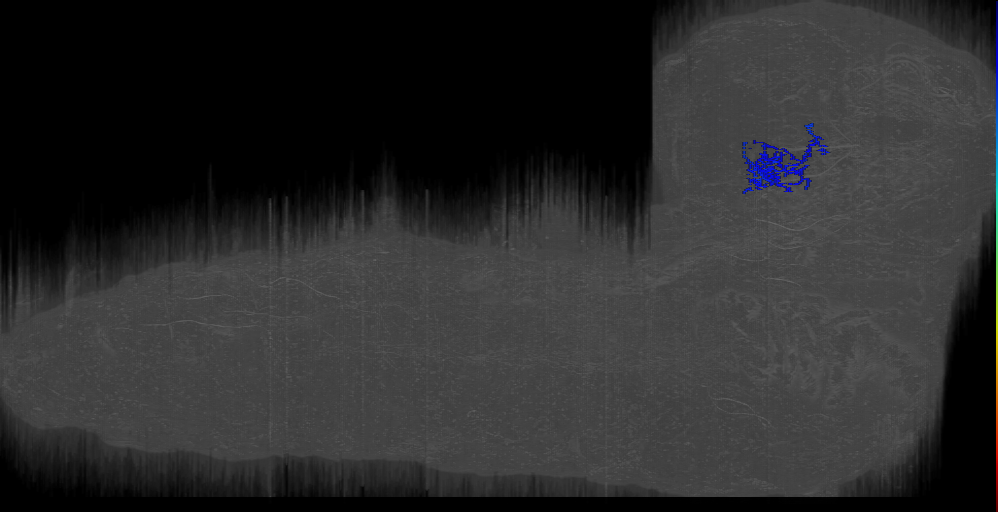 BLAv12_lat pointer 3 right; BLAv2 ant 1 ven neuron 8715941 (L1EM:8715940)