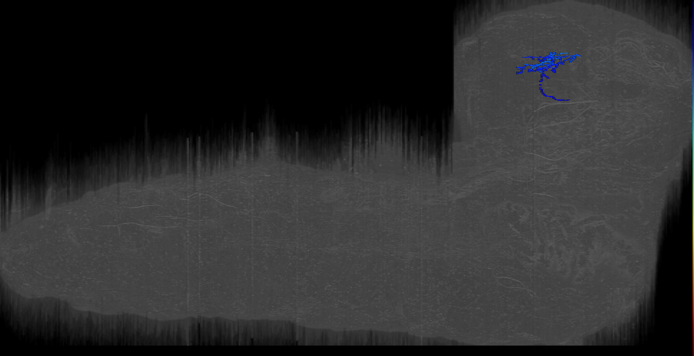 MIXED crinkled right; BLAd ant med 2 meets Larderet neuron 8812079 (L1EM:8812078)