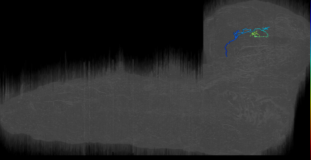 BLVa12 bilateral right; Mediates descend from LH (L1EM:8951591)