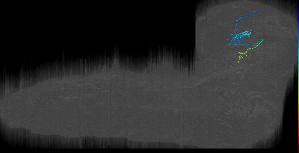 ni contralateral 2 right (L1EM:9072560)