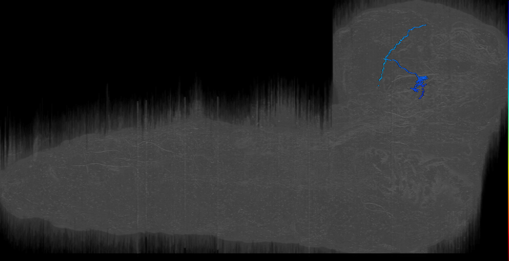 UNK brancher 4 right - missing dendrite (L1EM:9091922)