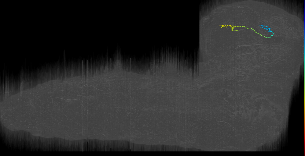 DPLm1 contralateral 2 left (L1EM:9237370)