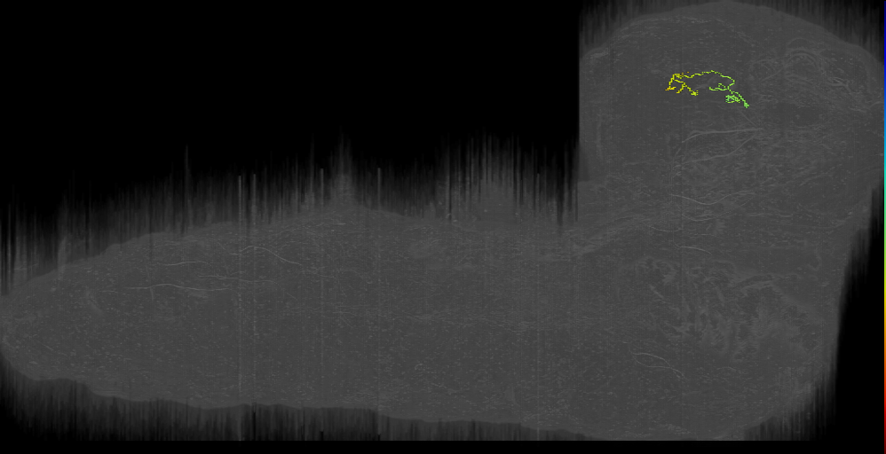 DPLc PDL_left (L1EM:9436520)