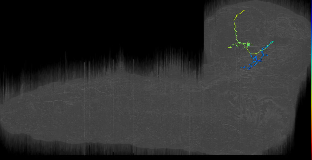 ni contralateral 3 left (L1EM:9480916)