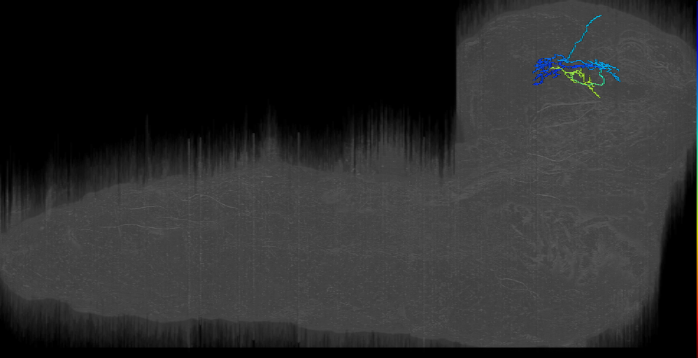 Another bilateral axon_35a right (L1EM:9585013)