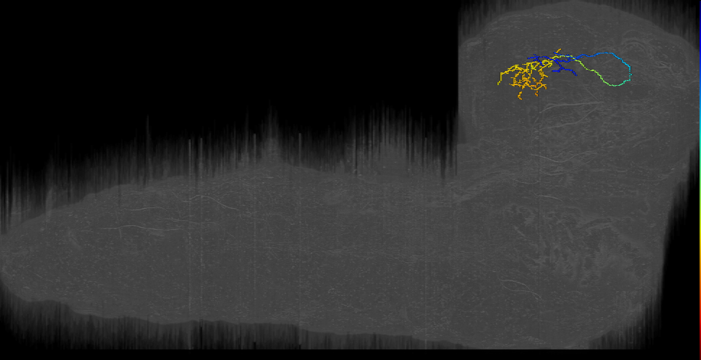DPLc_ant_lat bilateral left (L1EM:9792178)