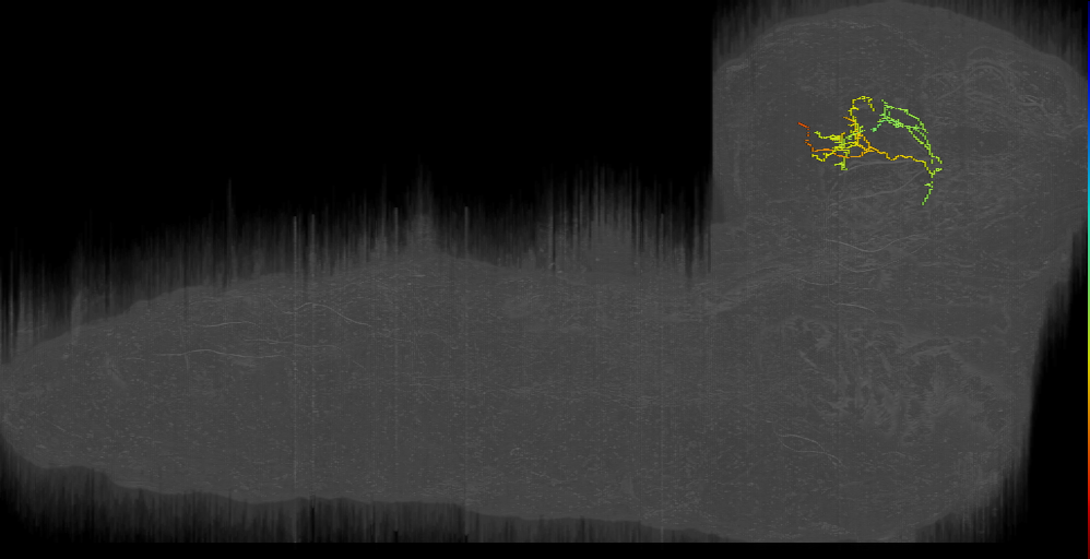 BLAl F neuron 1 left (L1EM:10345590)