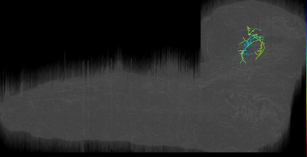 DPMm1 FB1_left (L1EM:10583715)