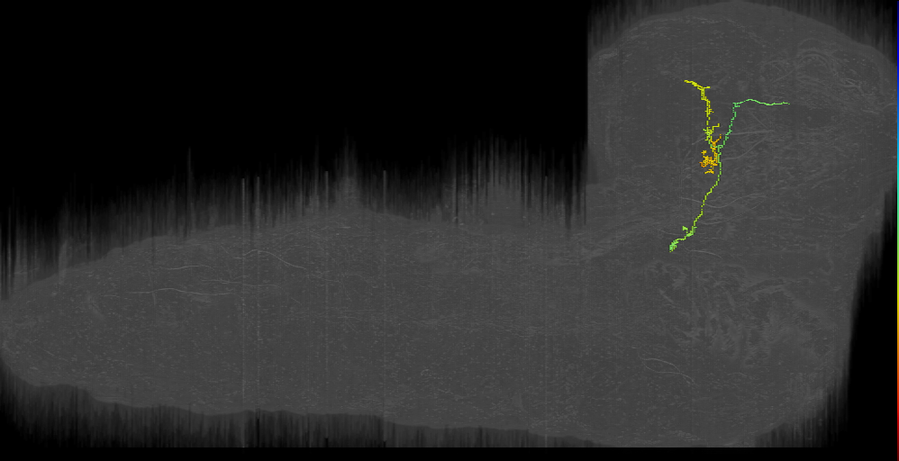 DPMm1 ipsilateral descending left (L1EM:10728323)