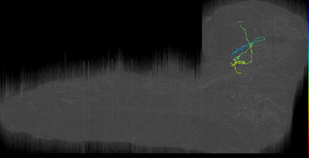 MB2ON-165 (L1EM:10792336)