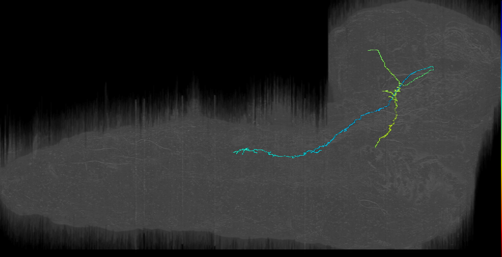 UNK descending contralateral left (L1EM:11013583)