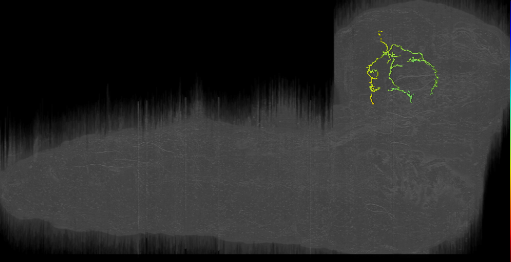 AF0: neuron left (L1EM:11027071)