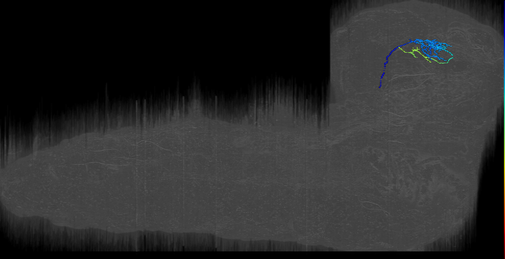 MB2ON-194 (L1EM:11356523)