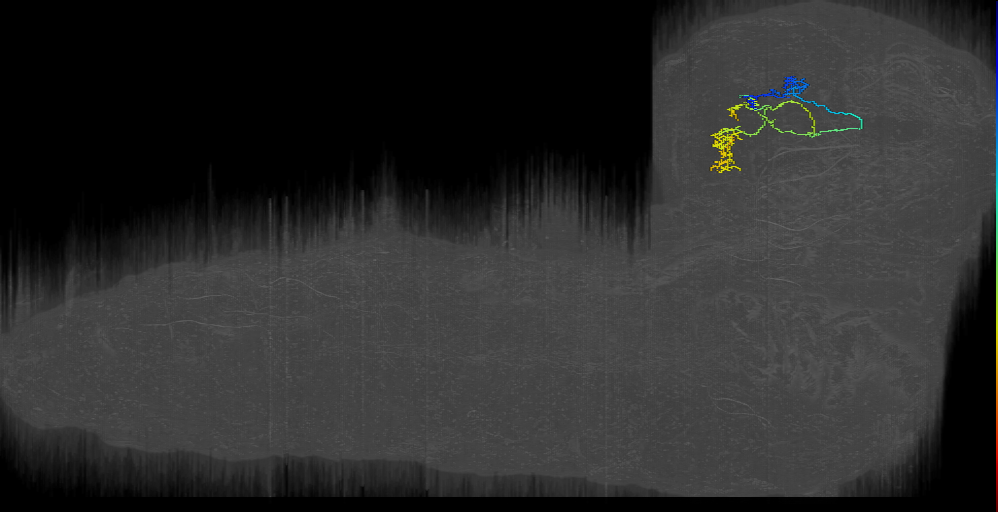 Horseshoe Bilateral Left (L1EM:11782821)