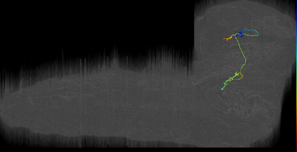 I of GPhN left (ipsilateral PN to LH) (L1EM:11986594)