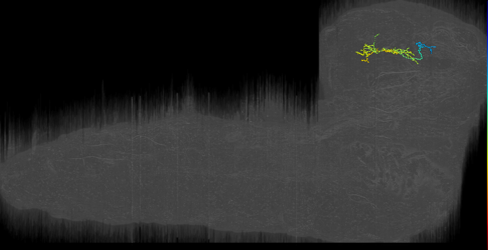 Another bilateral axon_35a left (L1EM:12281339)