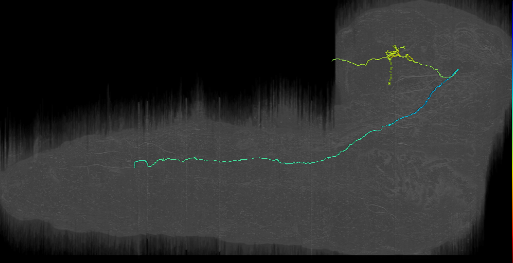 CP descending contralateral 1 left (L1EM:13422280)