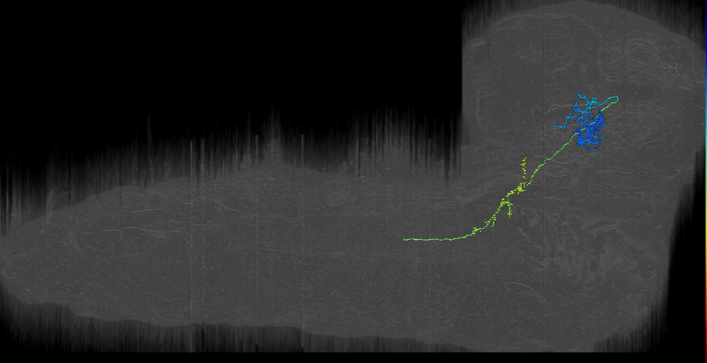 UNK contralateral descending 2 right (L1EM:13727202)