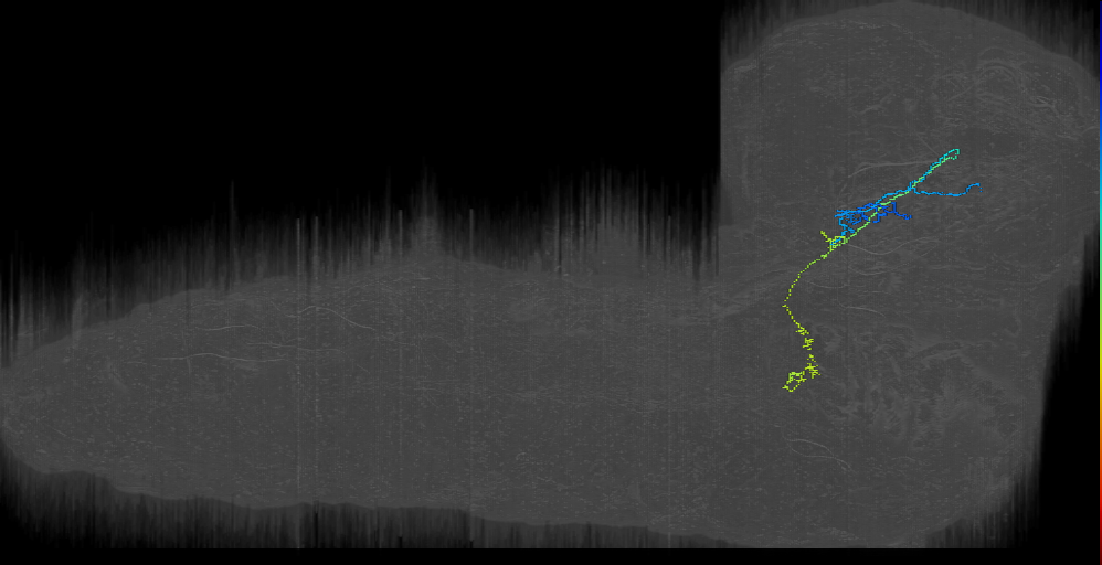 BAmd2 contralateral descending 2 right (L1EM:13842372)