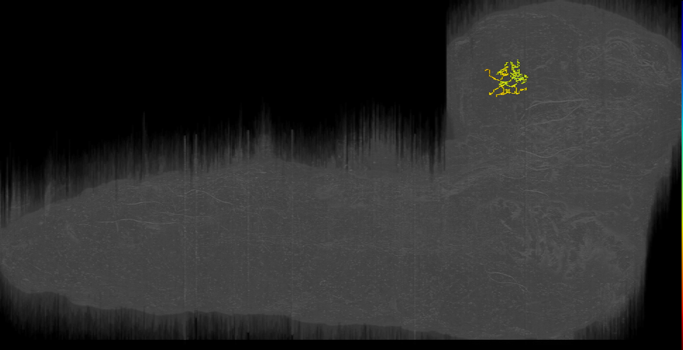 DPLp_left (L1EM:14450919)