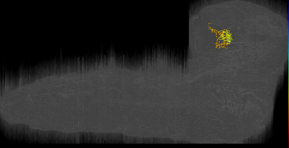 R1: upstream of telephone_left (L1EM:14519756)