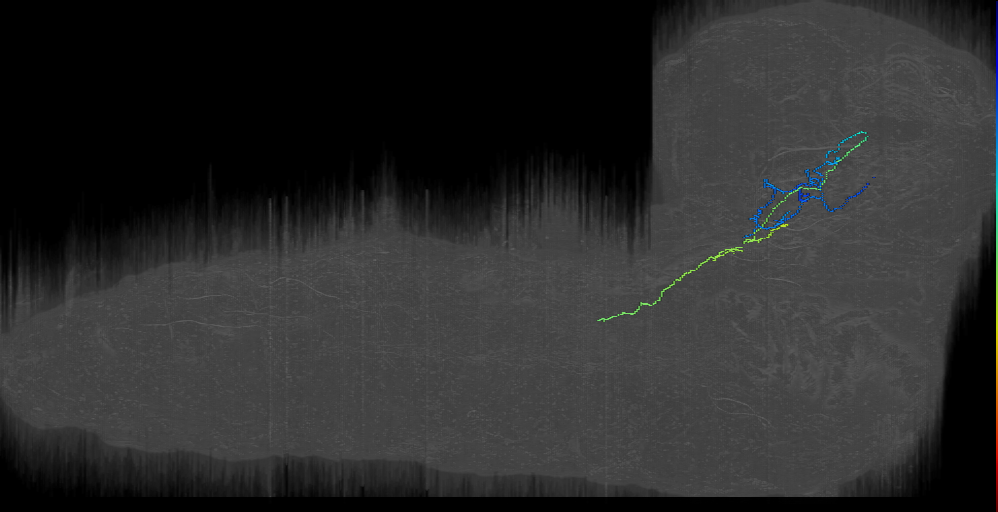 UNK contralateral descending right (L1EM:14588375)