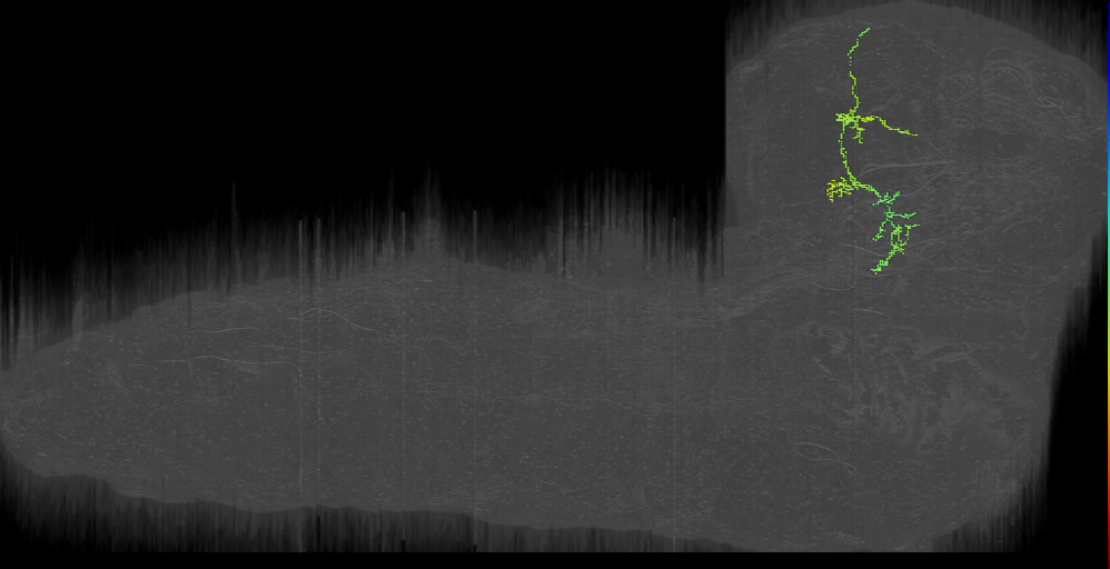 DPML1_l (L1EM:14655602)