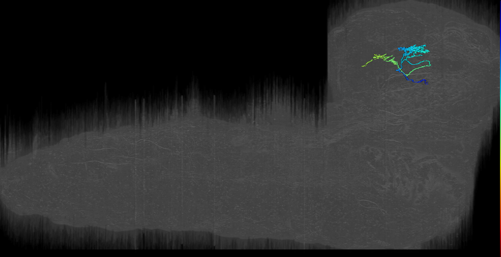 DALv1_PB4_right (L1EM:14757992)