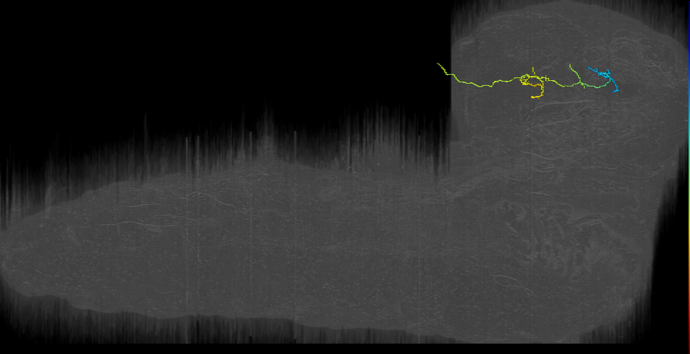 CPd bilateral 1 left (L1EM:15576292)