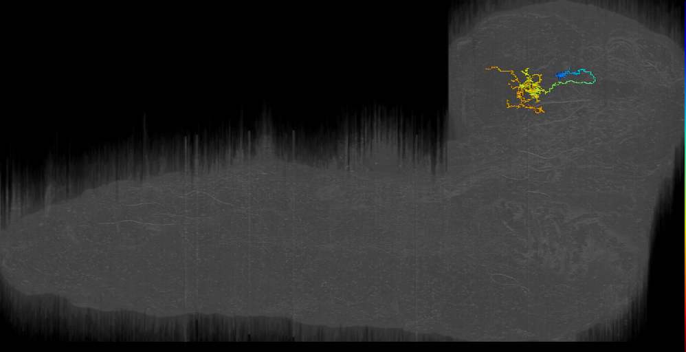 MB2IN-162/163 like left; Bilateral above BPL, DS BTL4_left (L1EM:15608953)