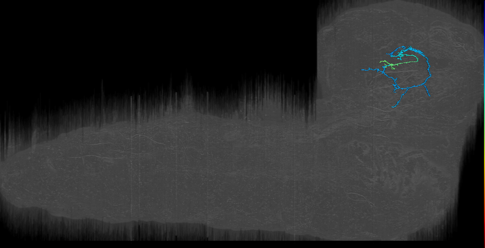 LX_right (L1EM:15610774)