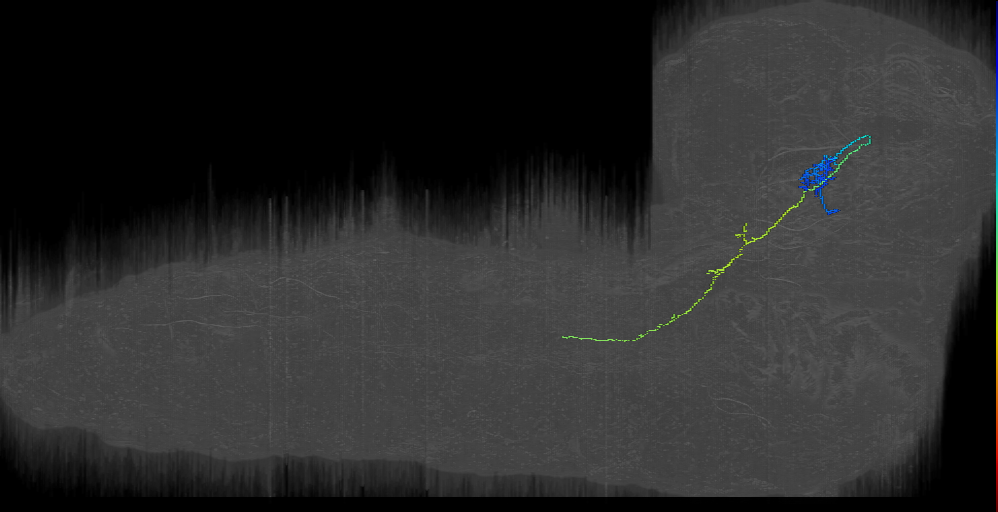 UNK contralateral 3 right (L1EM:15894278)