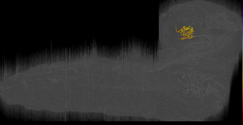 BLD interneuron left (L1EM:15985265)
