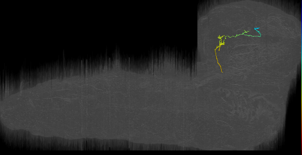 BLVa12 bilateral left (L1EM:16051878)
