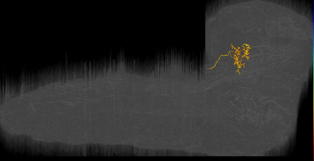 Local Crescent left (L1EM:16059078)