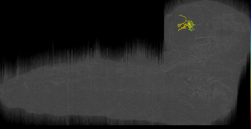 DPLm2 gnarled left (L1EM:16098538)