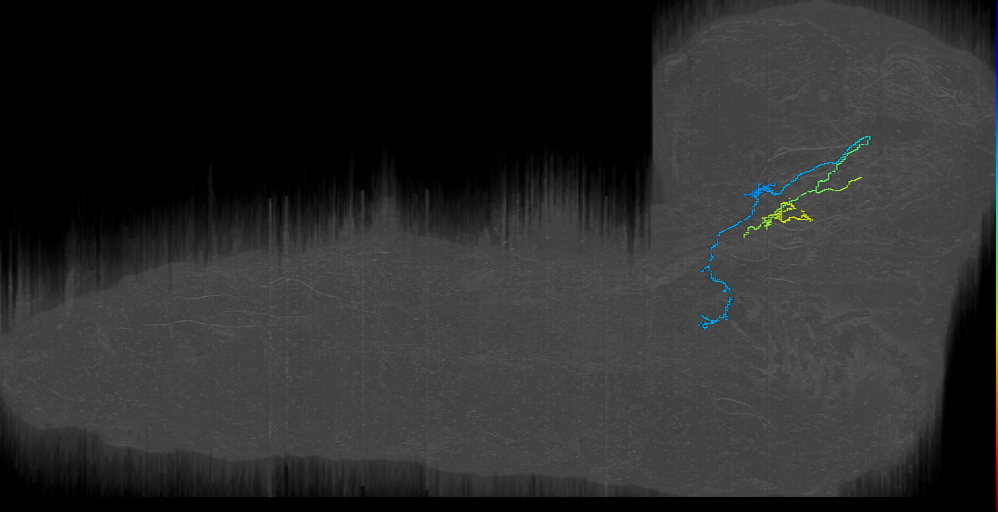 BAmd2 contralateral descending 1 left (L1EM:16561224)