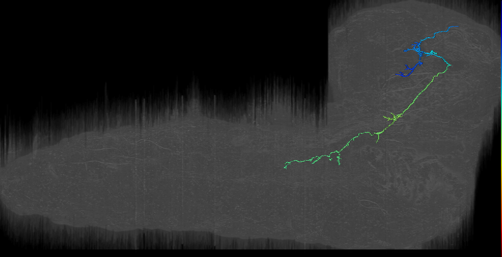 DPMl contralateral descending right (L1EM:16571210)