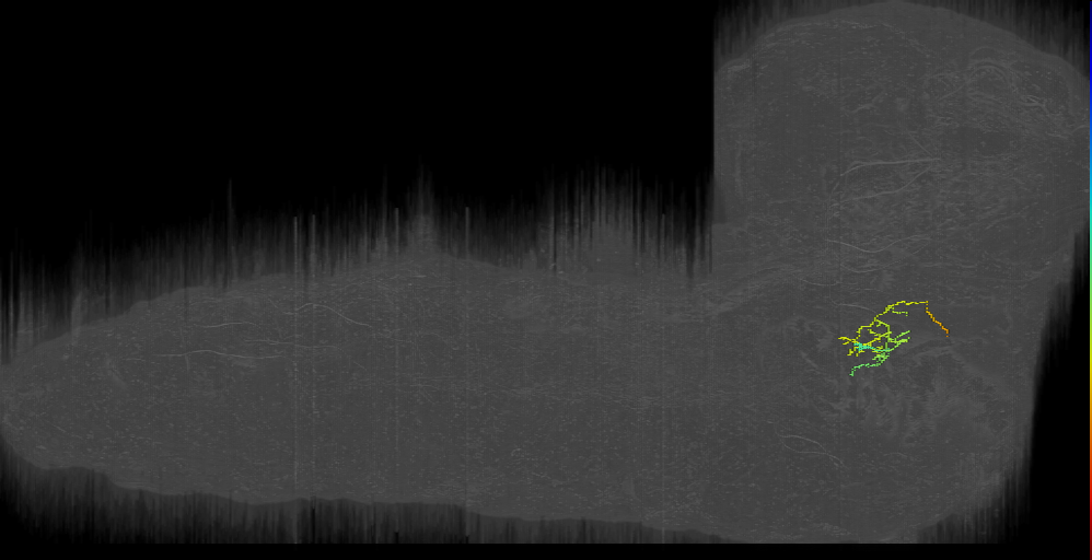 BAla34 descending left (L1EM:16588928)