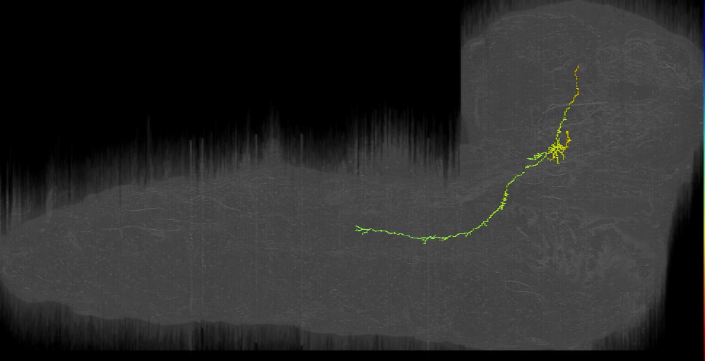 LAL output neuron 2 left (L1EM:16667306)