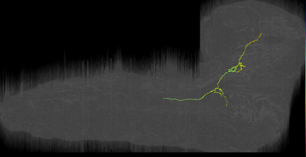 LAL output neuron DALcm left (L1EM:16852622)