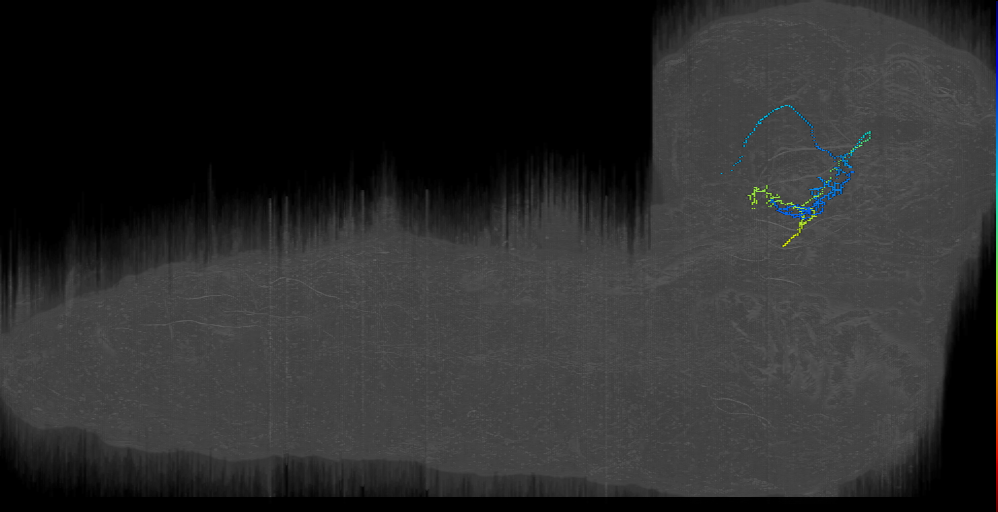 MB2ON-236 (L1EM:16924423)