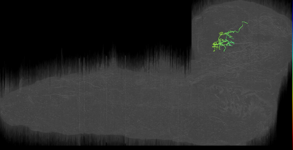 DPMm1 ipsilateral sheet left (L1EM:16937815)