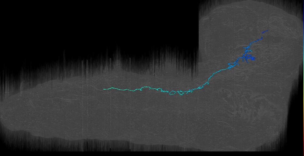 DALd descending 2 right; DALd_r 8 (L1EM:16950550)
