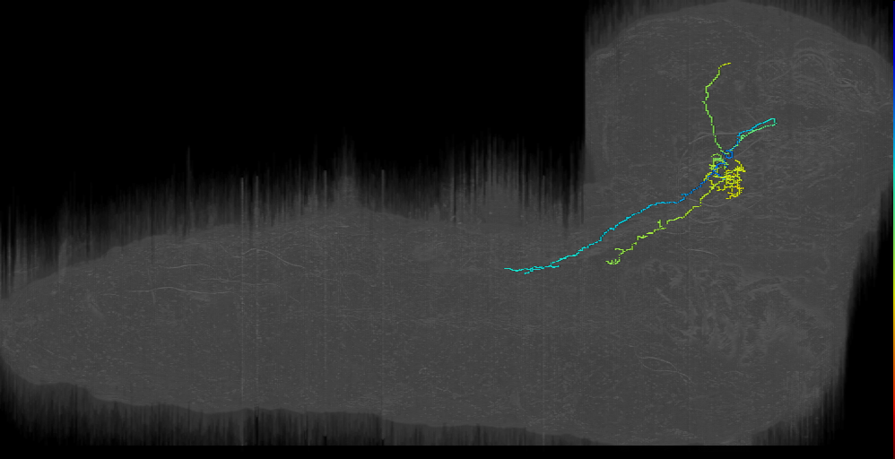 DPMm2 descending left (L1EM:17022668)