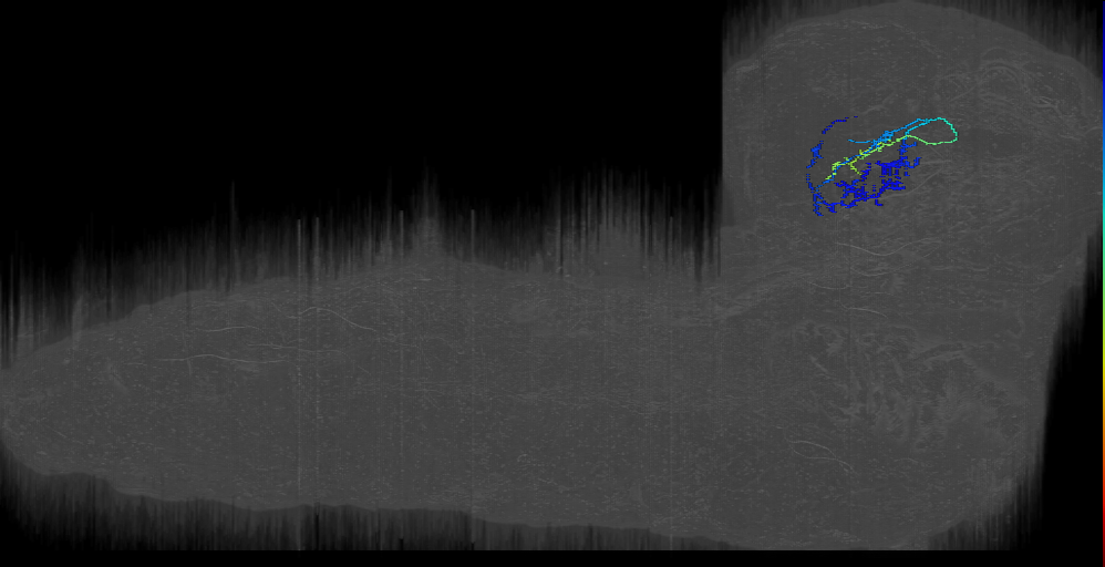 f_down pOLP right (L1EM:17123466)